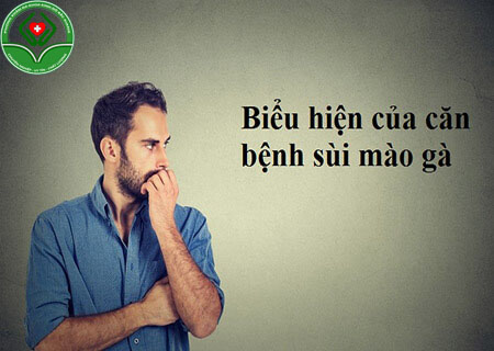 Biểu hiện dễ thấy của bệnh sùi mào gà Biểu hiện dễ thấy của bệnh sùi mào gà