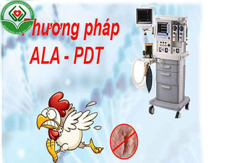 Phương pháp chữa bệnh sùi mào gà tại Kinh Đô