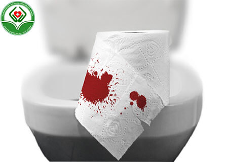 Triệu chứng của bệnh polyp hậu môn
