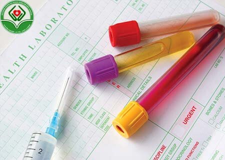 Các loại xét nghiệm nội tiết tố