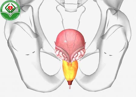 Niệu đạo bị kích thích dẫn đến bệnh