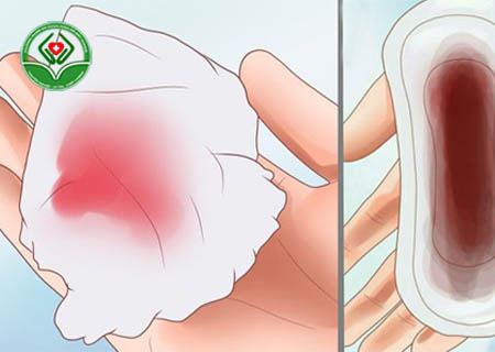 Chảy máu khi quan hệ có nguy hiểm không?