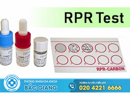Xét nghiệm RPR là gì?