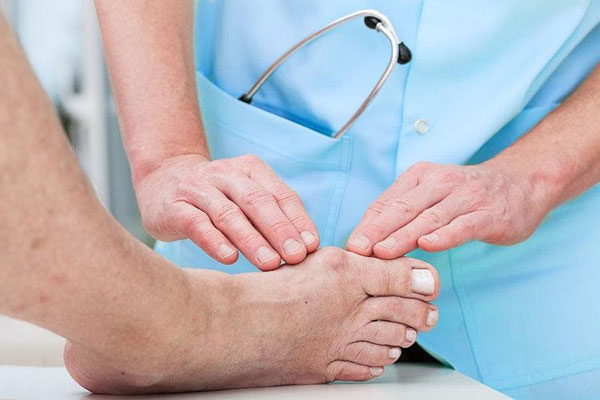 Dấu hiệu bệnh gout ở chân tay dễ nhận biết nhất