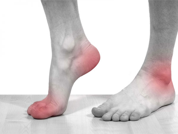Gout có biểu hiện đau tại các khớp hay vùng ngón chân