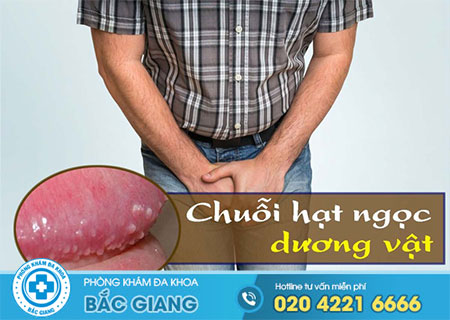 Chuỗi hạt ngọc dương vật có thực sự nguy hiểm?