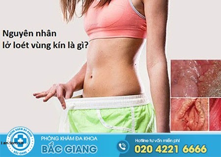 Lở loét vùng kín cảnh báo bệnh gì?