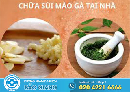 Mẹo chữa sùi mào gà tại nhà